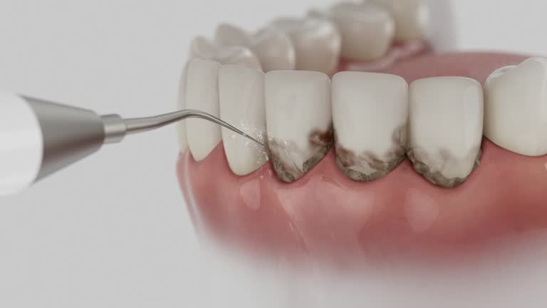 Reliable Dental contractor in Accokeek, MD by Dentist Open Now